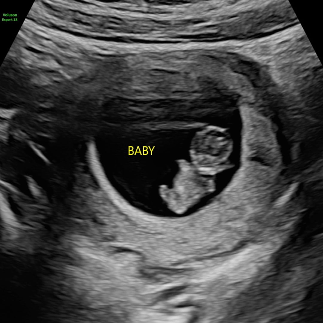 Photo shared by Chloe for their Babylist baby registry.