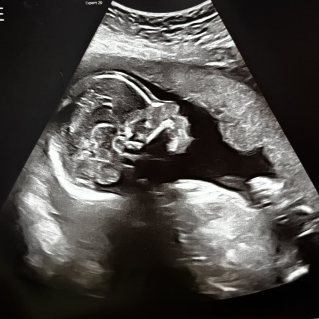 Photo shared by Marissa for their Babylist baby registry.