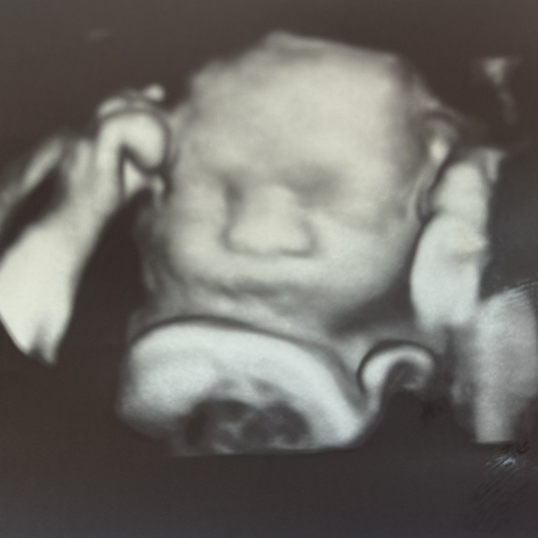 Photo shared by Alexa Fernanda for their Babylist baby registry.