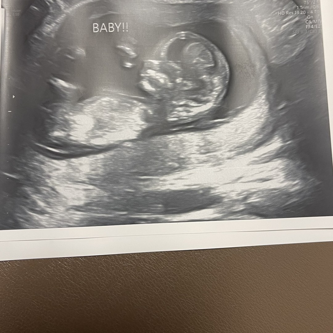 Photo shared by Emily for their Babylist baby registry.