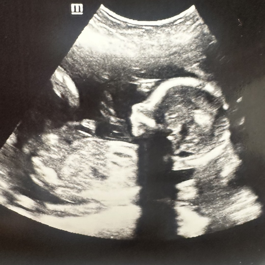 Photo shared by Evelyn for their Babylist baby registry.