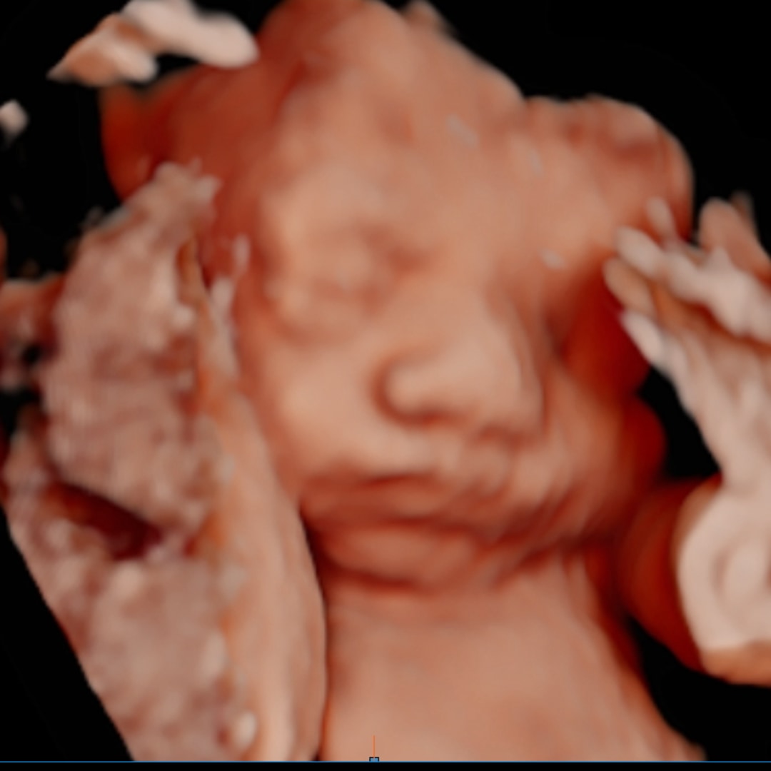 Photo shared by Lillian for their Babylist baby registry.