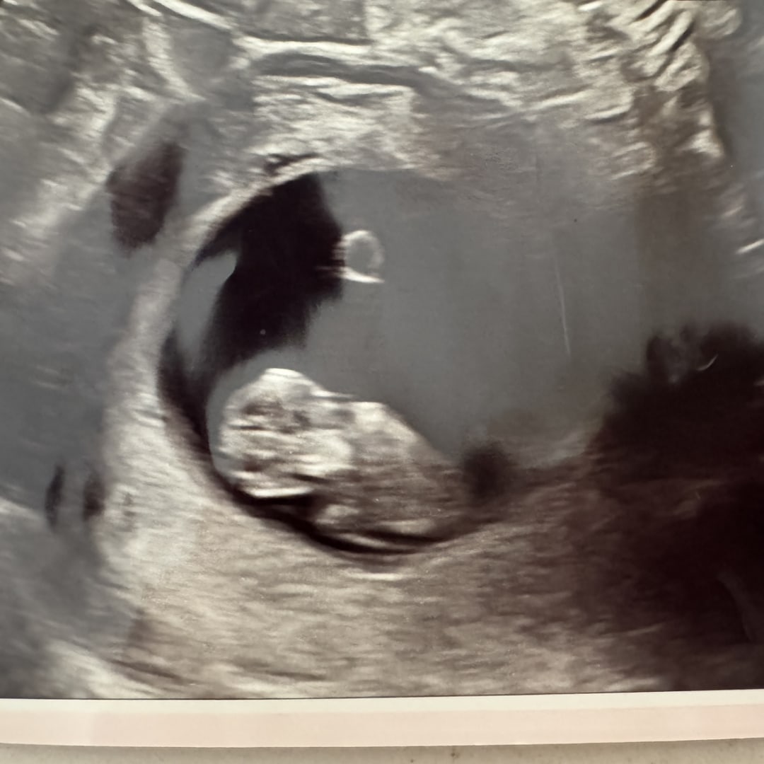 Photo shared by Megan for their Babylist baby registry.