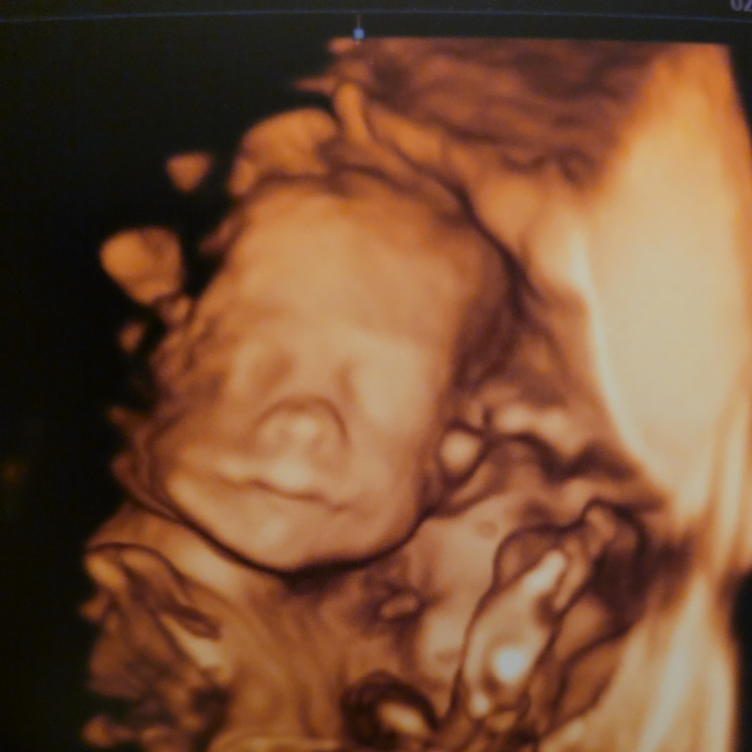 Photo shared by Stephanie for their Babylist baby registry.