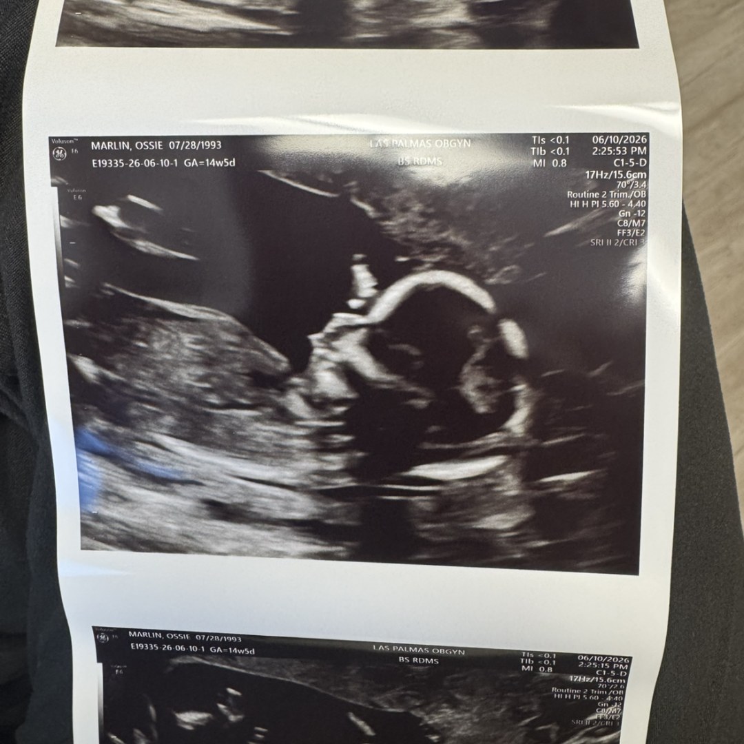 Photo shared by Ossie for their Babylist baby registry.