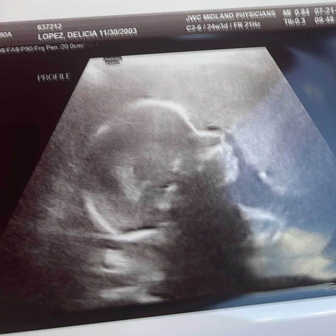 Photo shared by Delicia for their Babylist baby registry.
