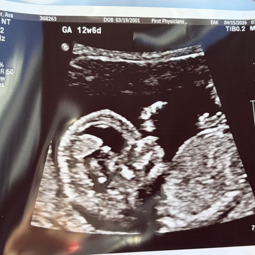 Photo shared by Ava for their Babylist baby registry.