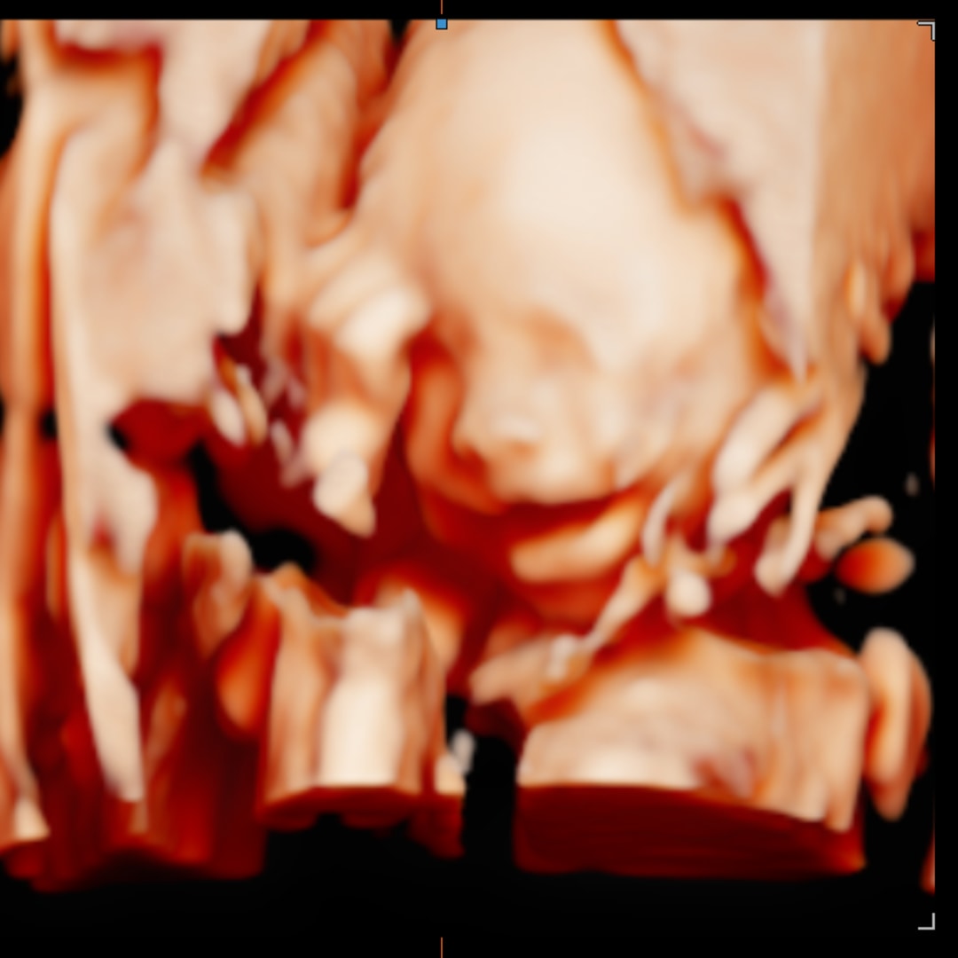 Photo shared by MaryJo for their Babylist baby registry.