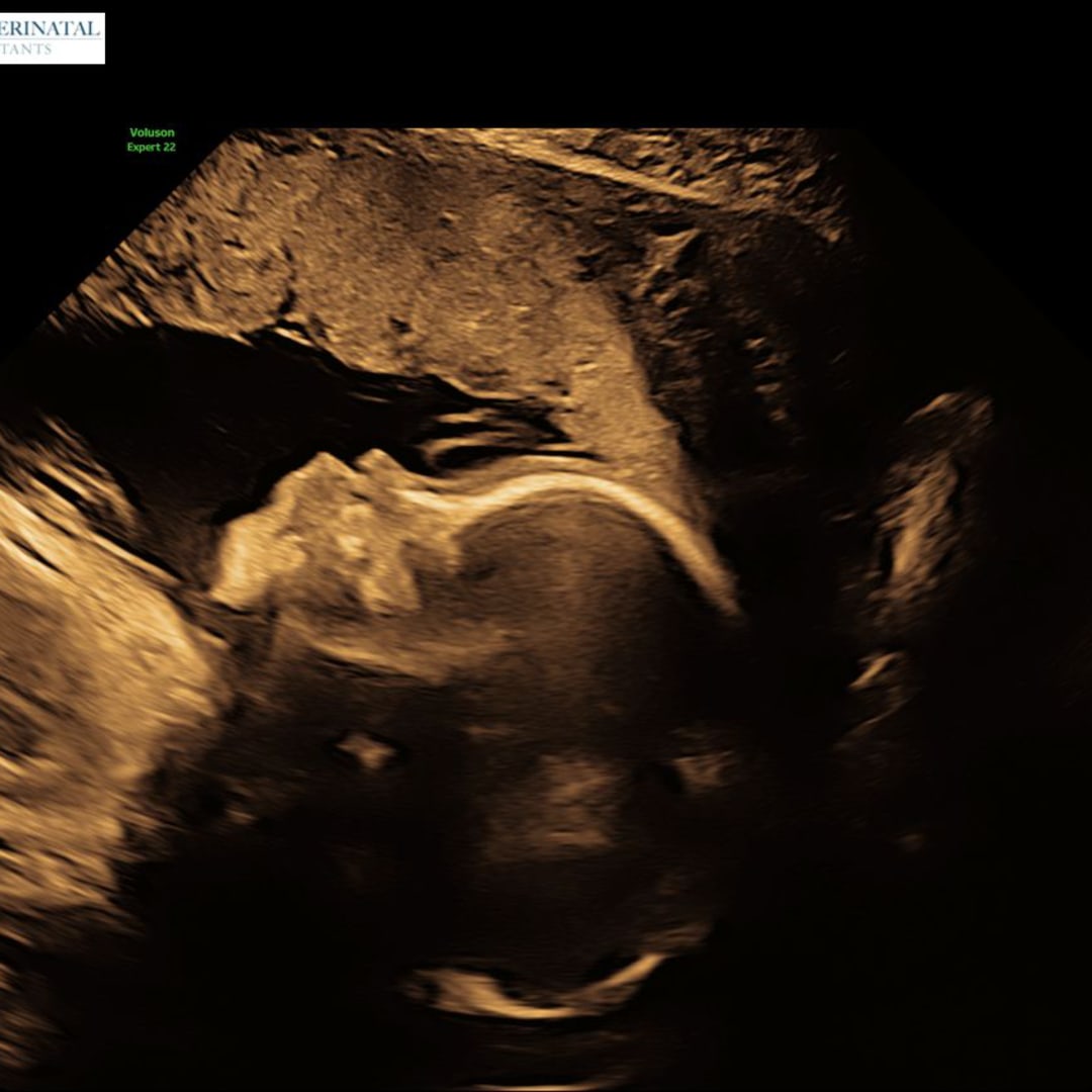 Photo shared by Jessica for their Babylist baby registry.