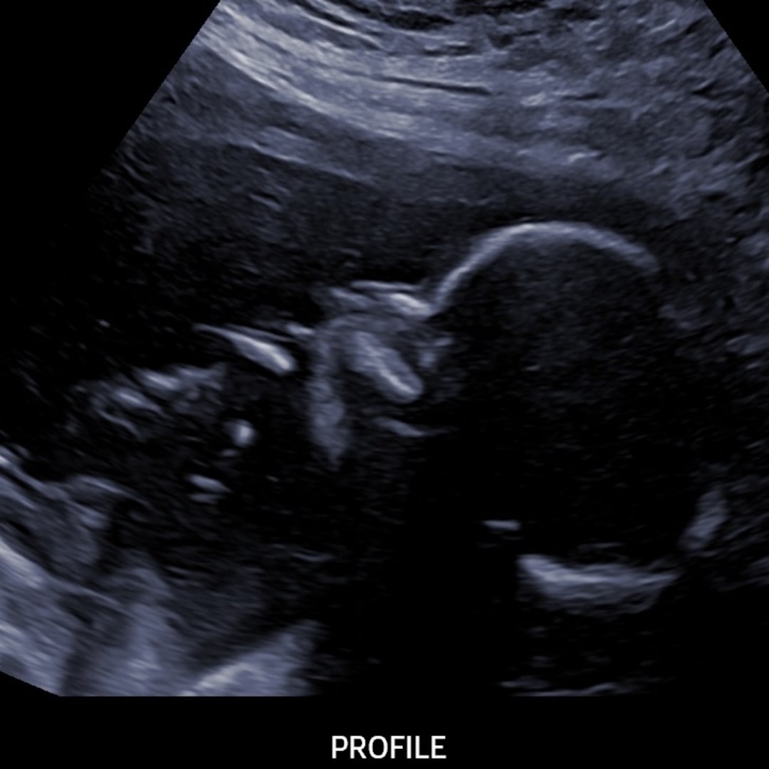 Photo shared by Shannon for their Babylist baby registry.