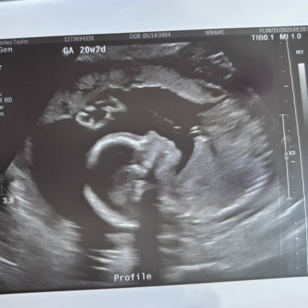 Photo shared by Briley for their Babylist baby registry.