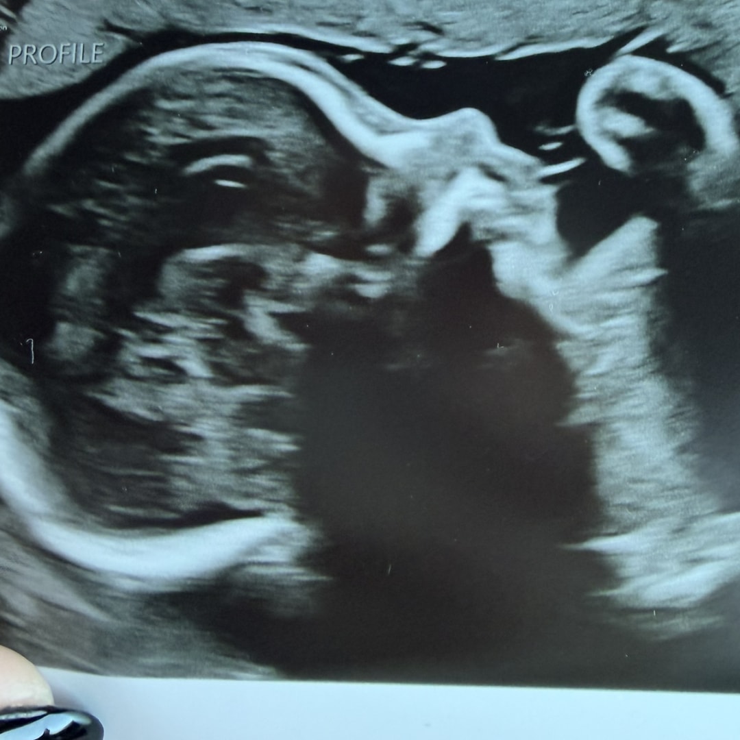 Photo shared by Dana for their Babylist baby registry.