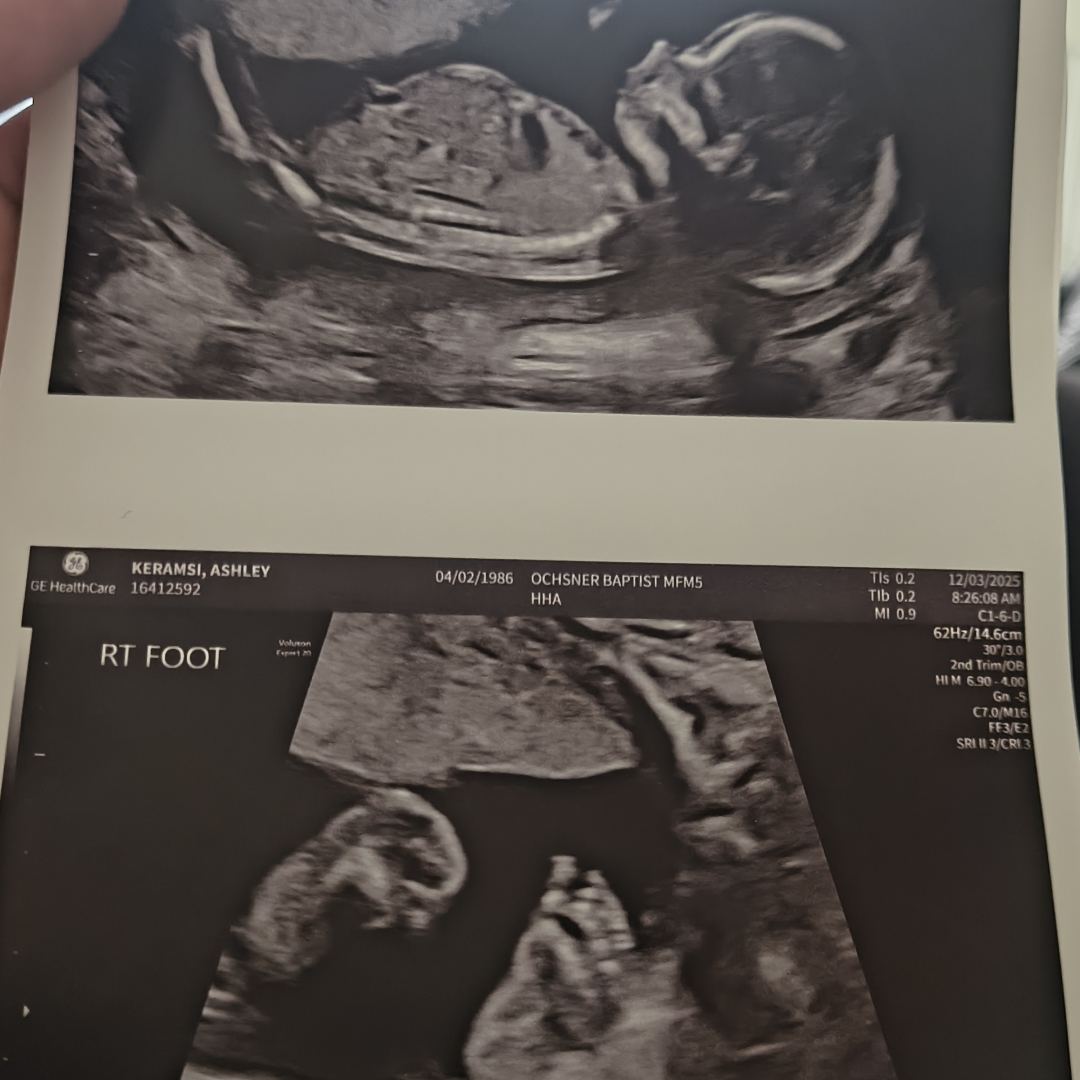 Photo shared by Ashley for their Babylist baby registry.