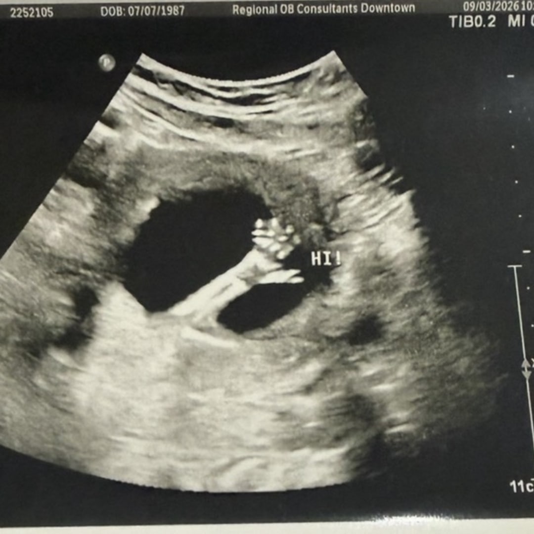 Photo shared by Kelley for their Babylist baby registry.