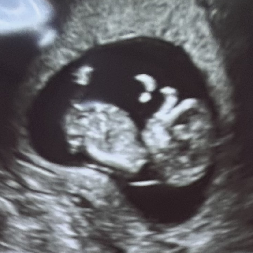 Photo shared by Anna for their Babylist baby registry.