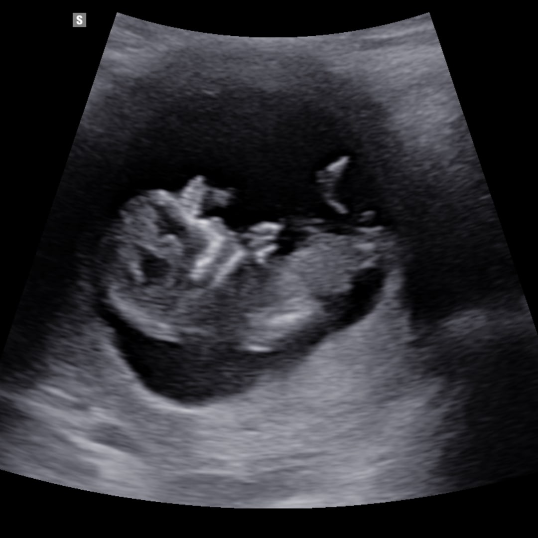 Photo shared by Rose for their Babylist baby registry.