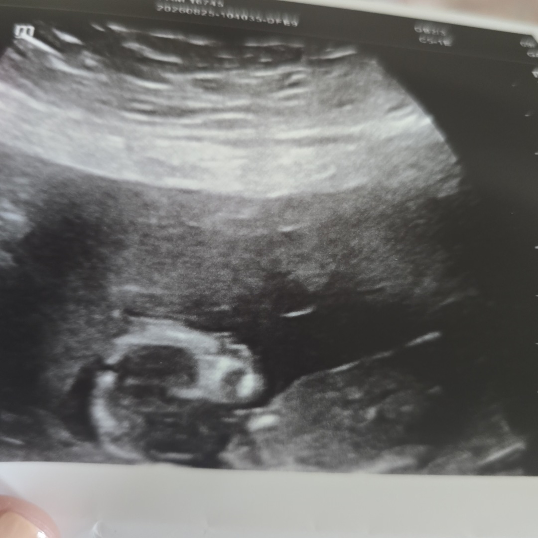 Photo shared by Stephanie for their Babylist baby registry.