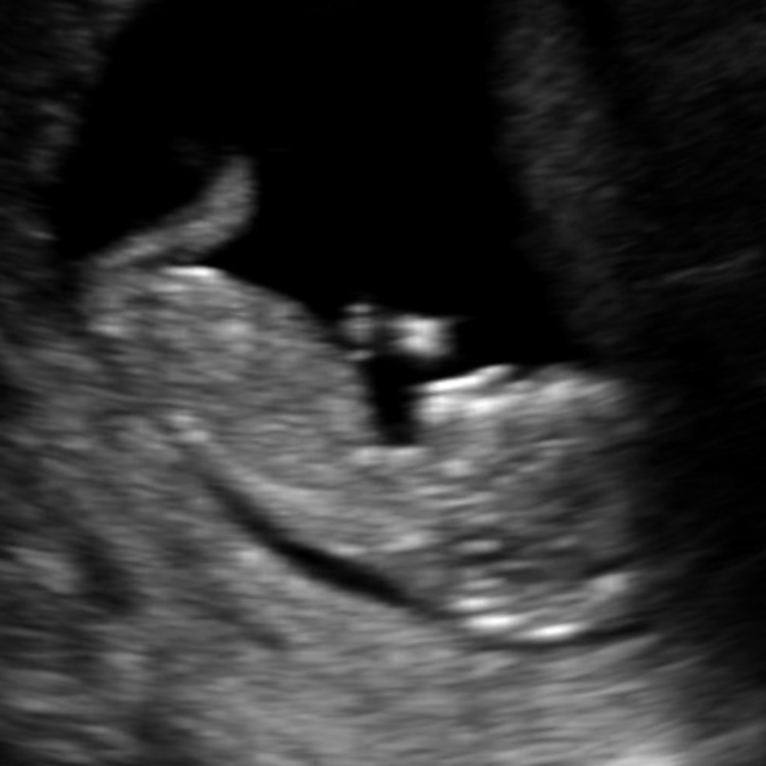Photo shared by Lisa for their Babylist baby registry.