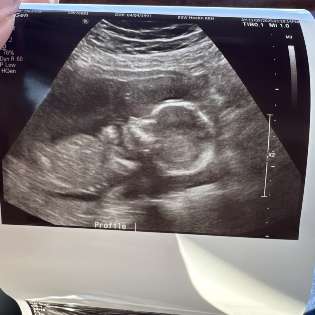 Photo shared by DeAnna for their Babylist baby registry.