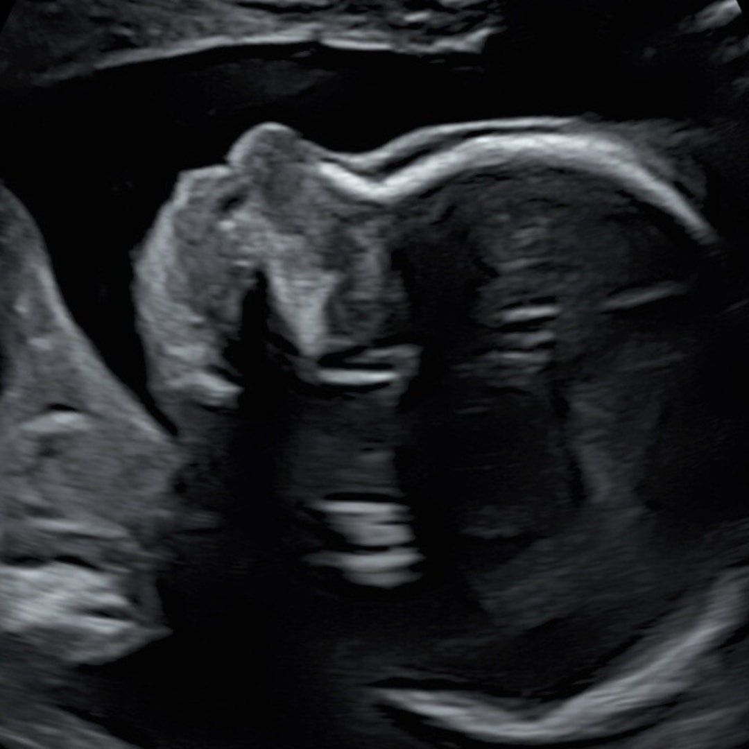 Photo shared by Shanna for their Babylist baby registry.