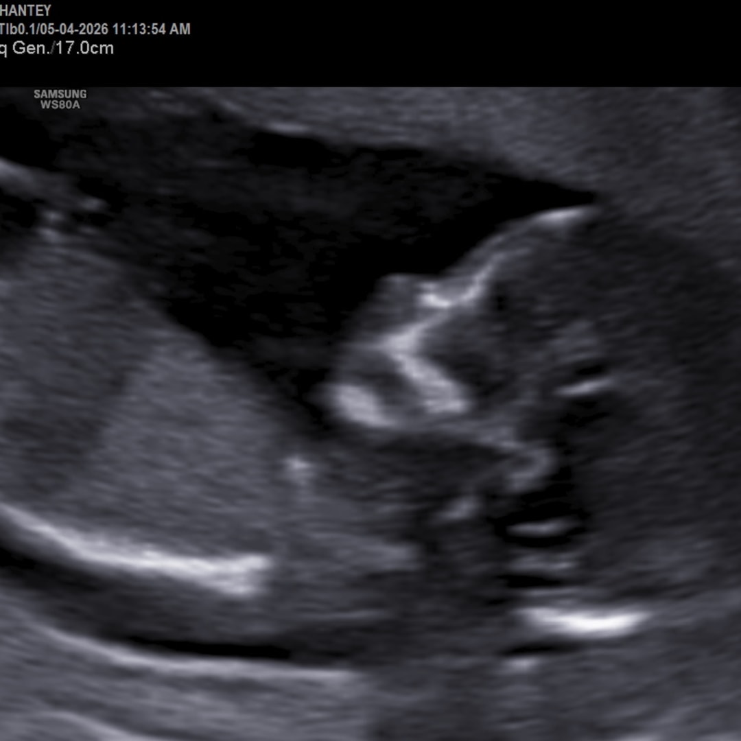 Photo shared by Chantey for their Babylist baby registry.