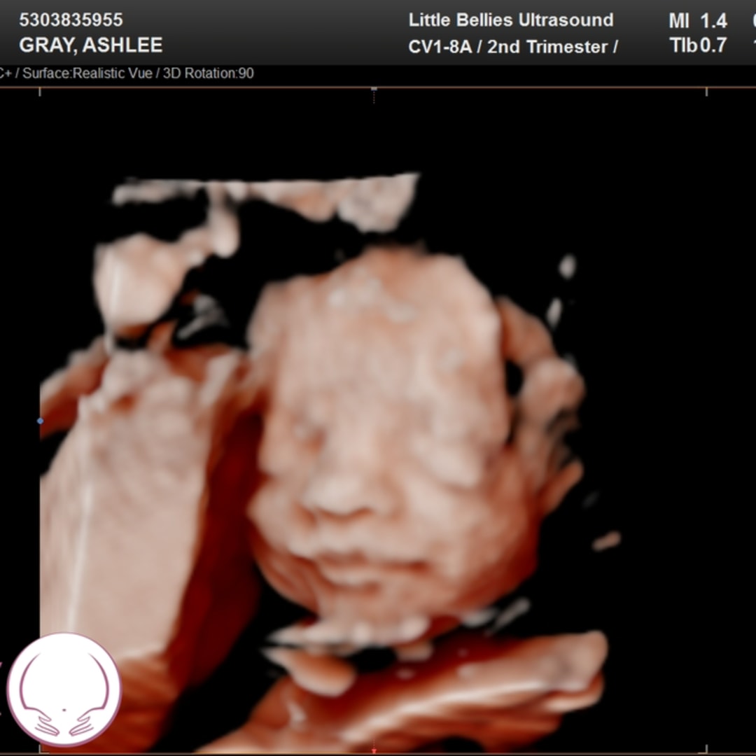 Photo shared by Ashlee for their Babylist baby registry.