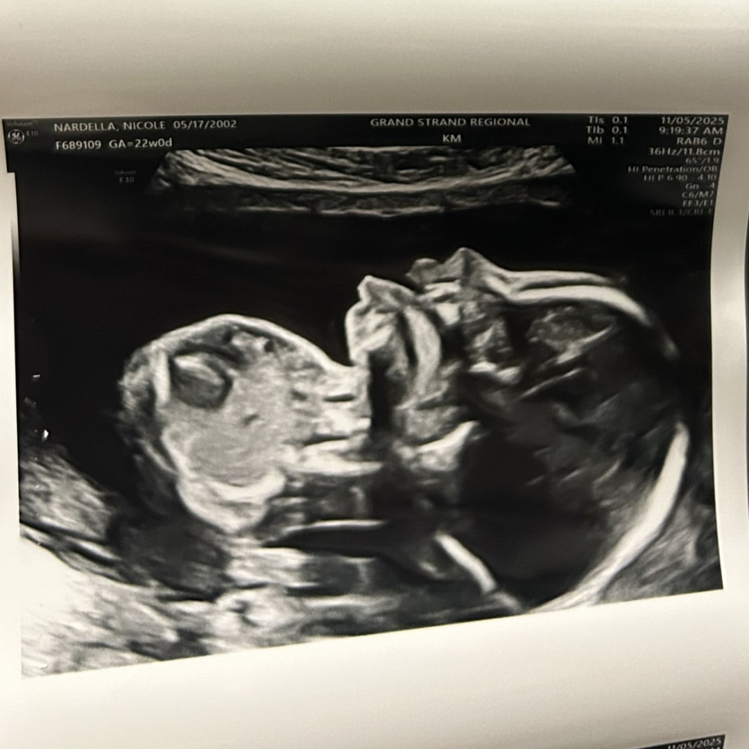 Photo shared by Nicole for their Babylist baby registry.