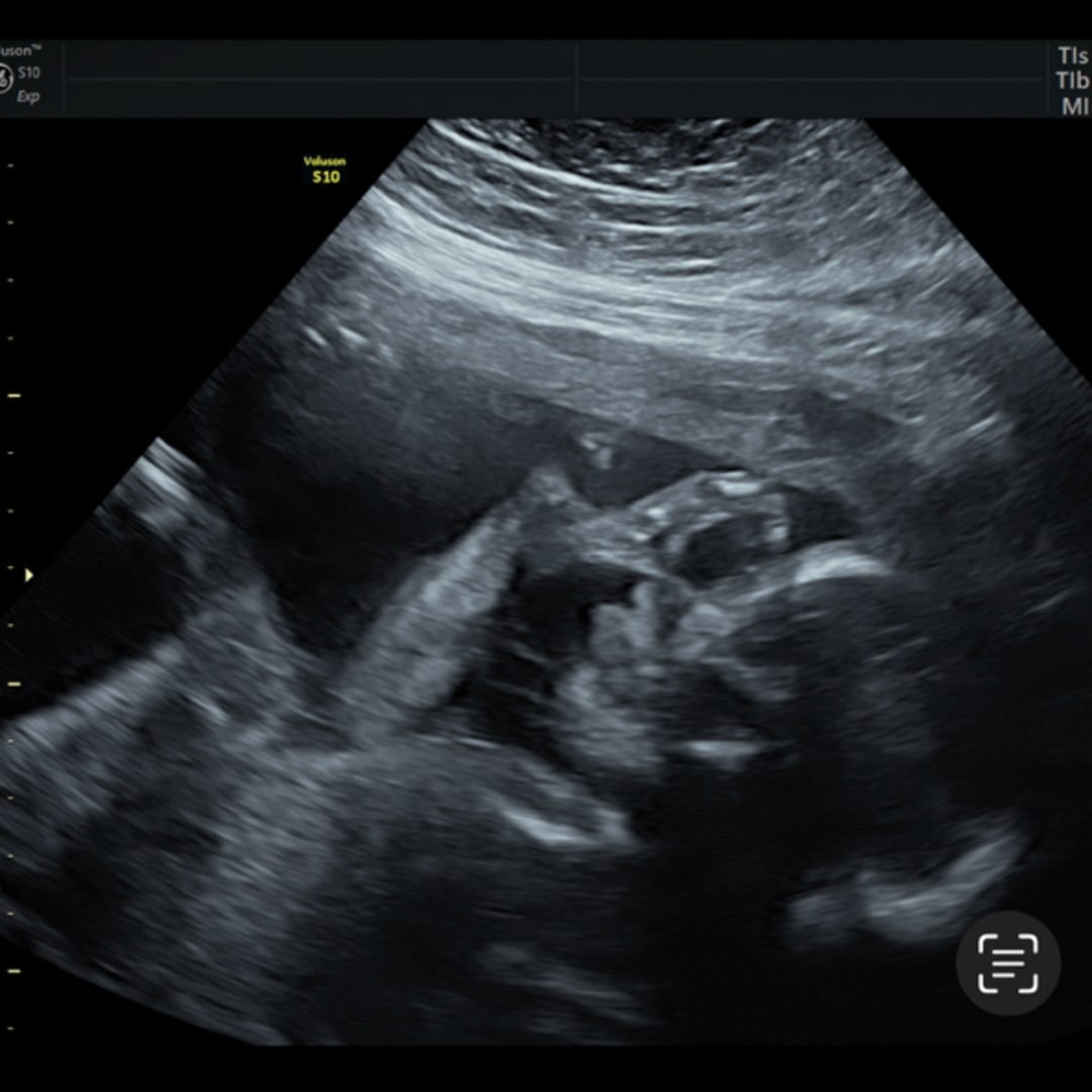 Photo shared by Lauren for their Babylist baby registry.