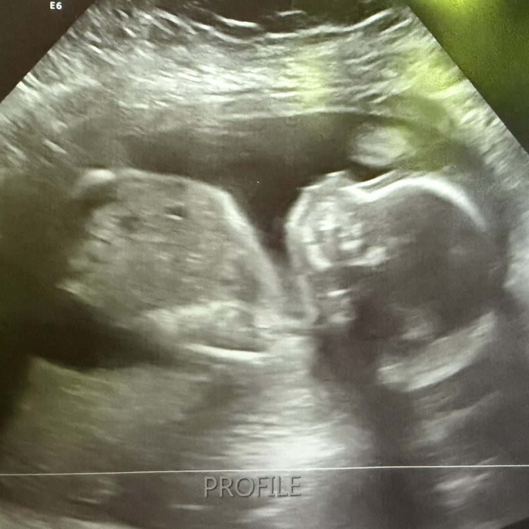 Photo shared by Graziella for their Babylist baby registry.