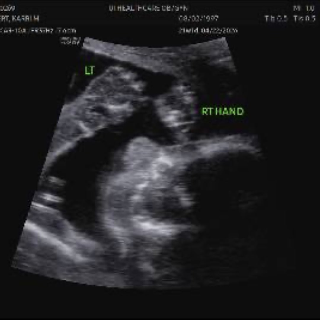 Photo shared by Karri for their Babylist baby registry.