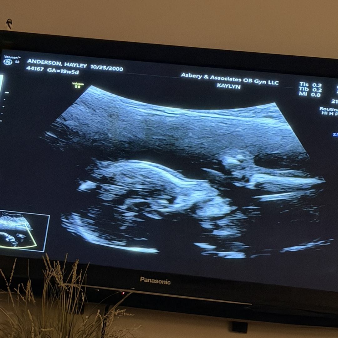 Photo shared by Hayley for their Babylist baby registry.