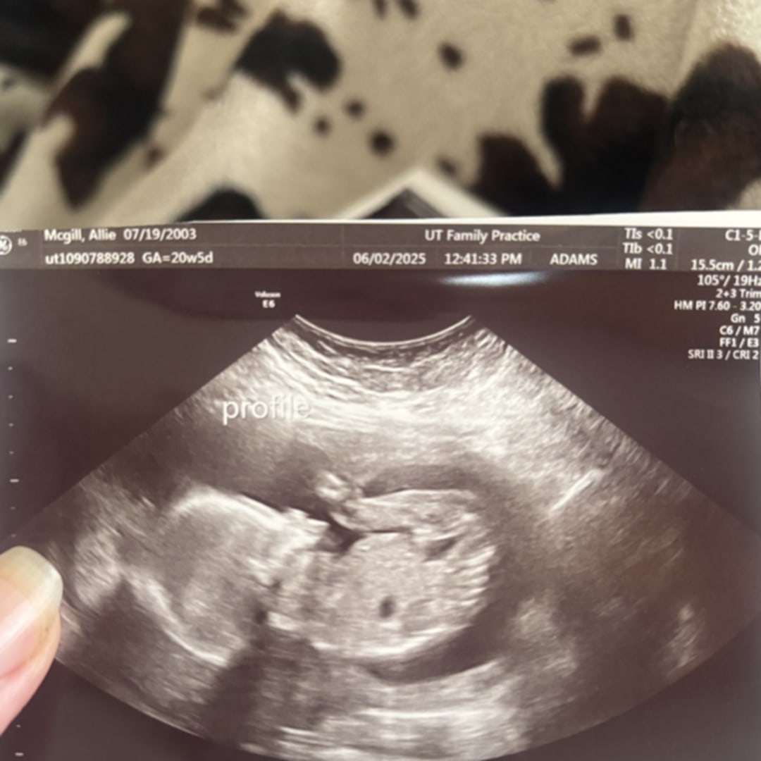 Photo shared by Allie for their Babylist baby registry.
