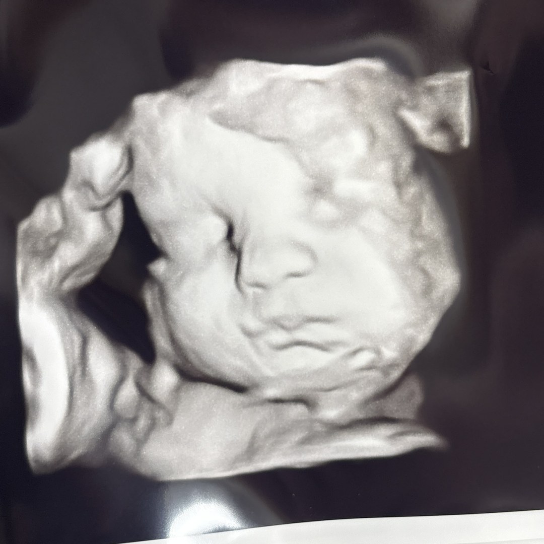Photo shared by Alexis for their Babylist baby registry.