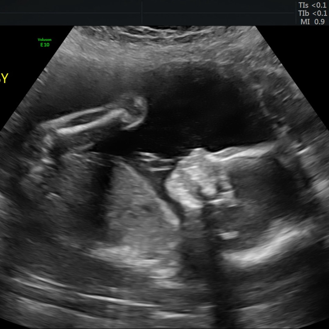 Photo shared by Brennah for their Babylist baby registry.