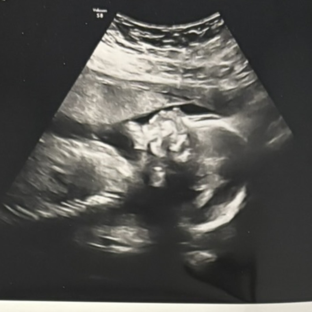 Photo shared by Kiara for their Babylist baby registry.