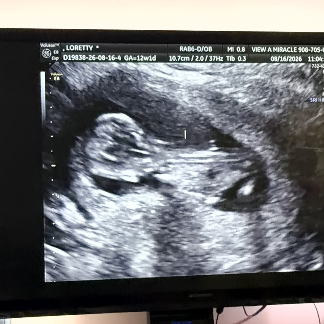 Photo shared by Alan for their Babylist baby registry.