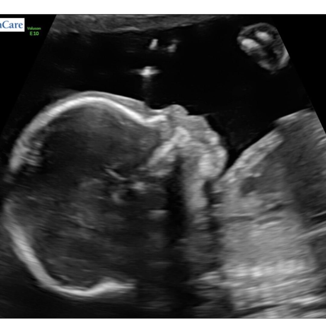 Photo shared by Janasia for their Babylist baby registry.