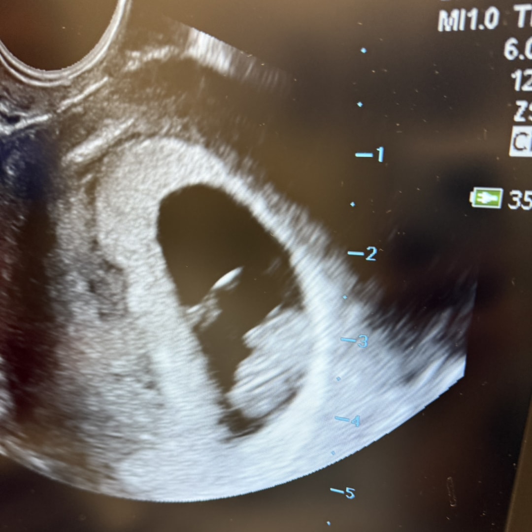 Photo shared by James for their Babylist baby registry.