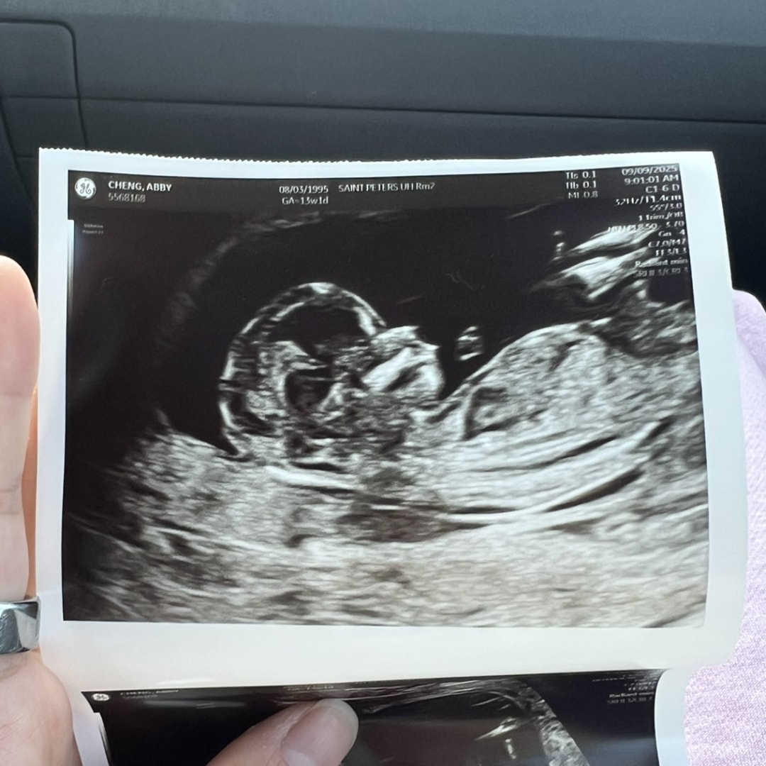 Photo shared by Abby for their Babylist baby registry.