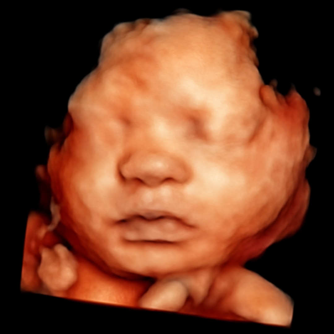 Photo shared by Mira for their Babylist baby registry.