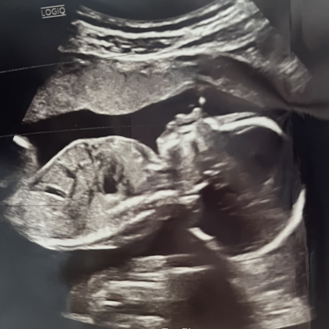 Photo shared by Paige for their Babylist baby registry.