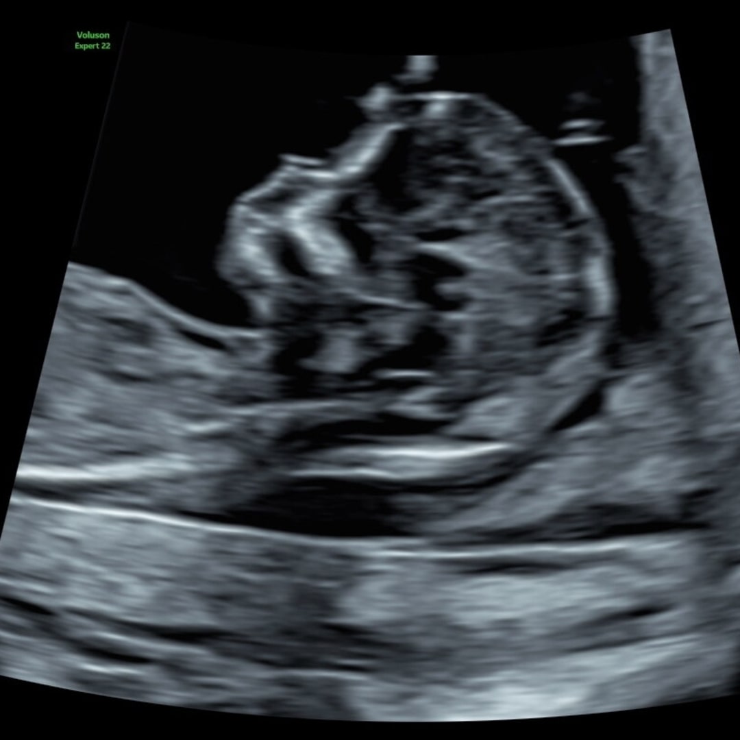 Photo shared by Jemima for their Babylist baby registry.