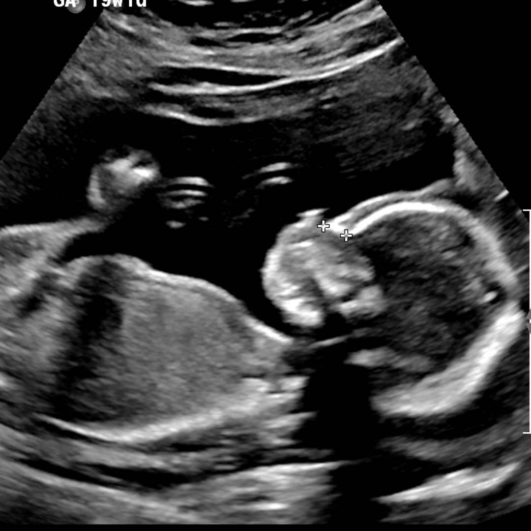 Photo shared by Veronica for their Babylist baby registry.