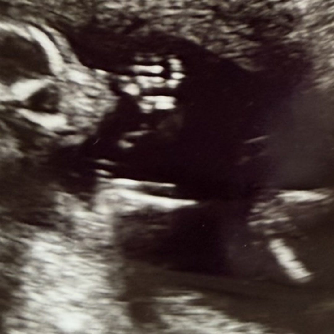 Photo shared by Abby Rose for their Babylist baby registry.