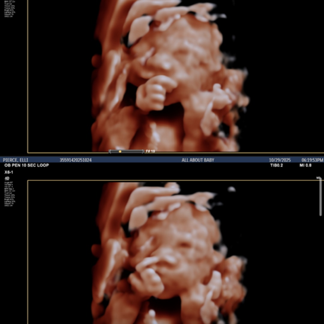 Photo shared by Elli for their Babylist baby registry.