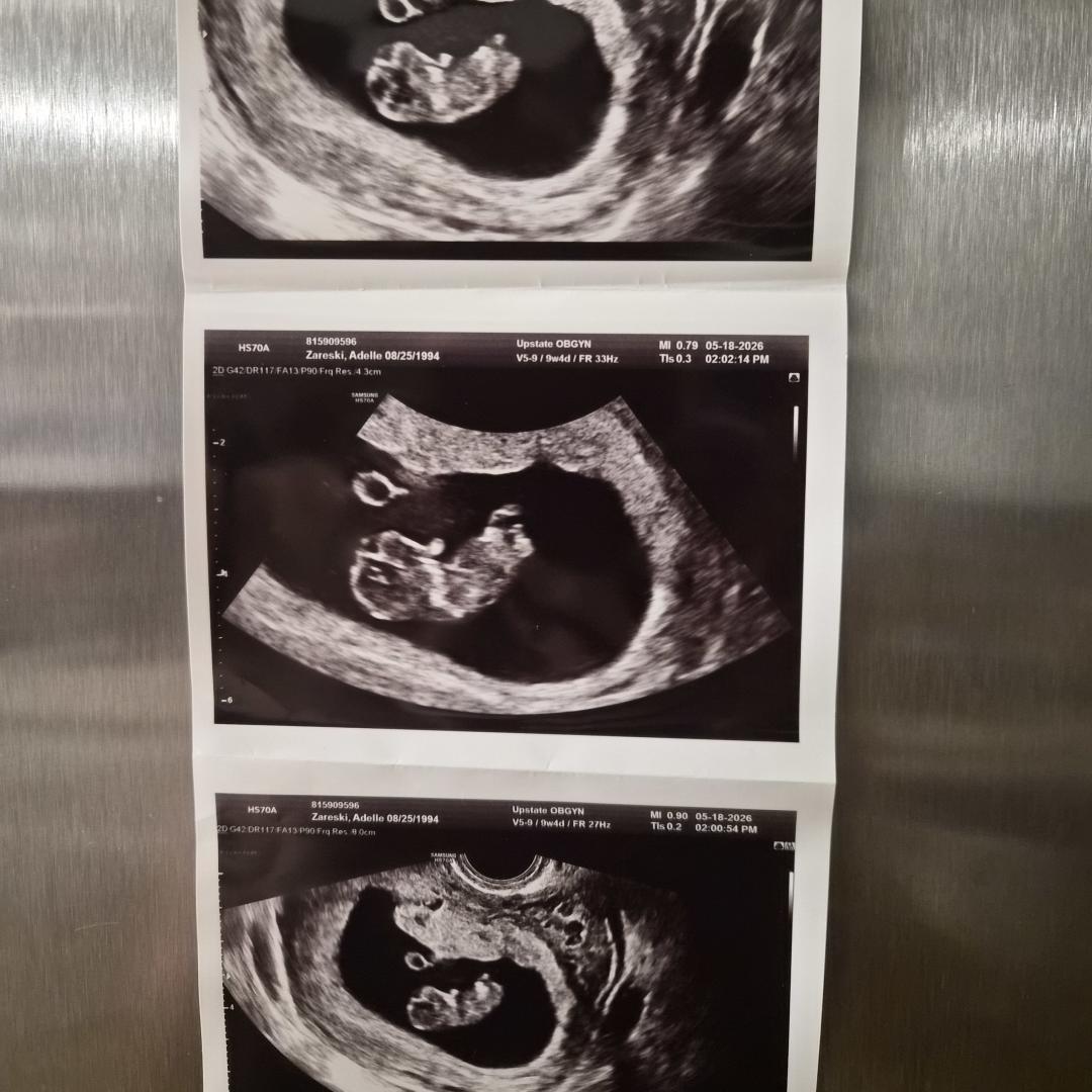 Photo shared by Adelle for their Babylist baby registry.