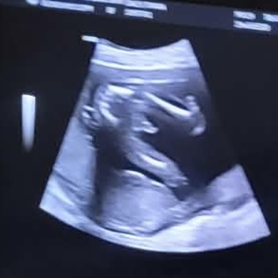Photo shared by Tiyana for their Babylist baby registry.