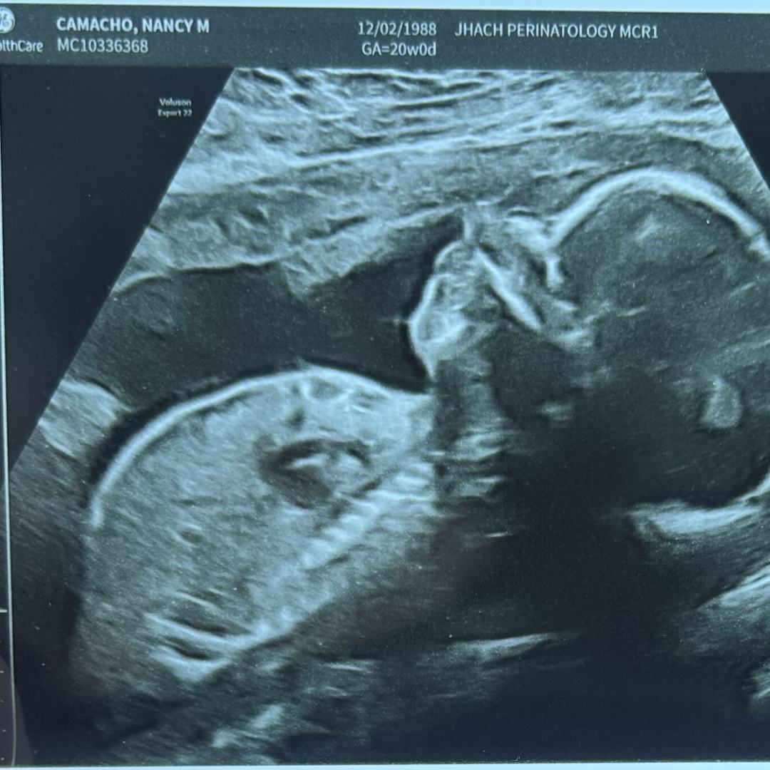 Photo shared by Nancy for their Babylist baby registry.