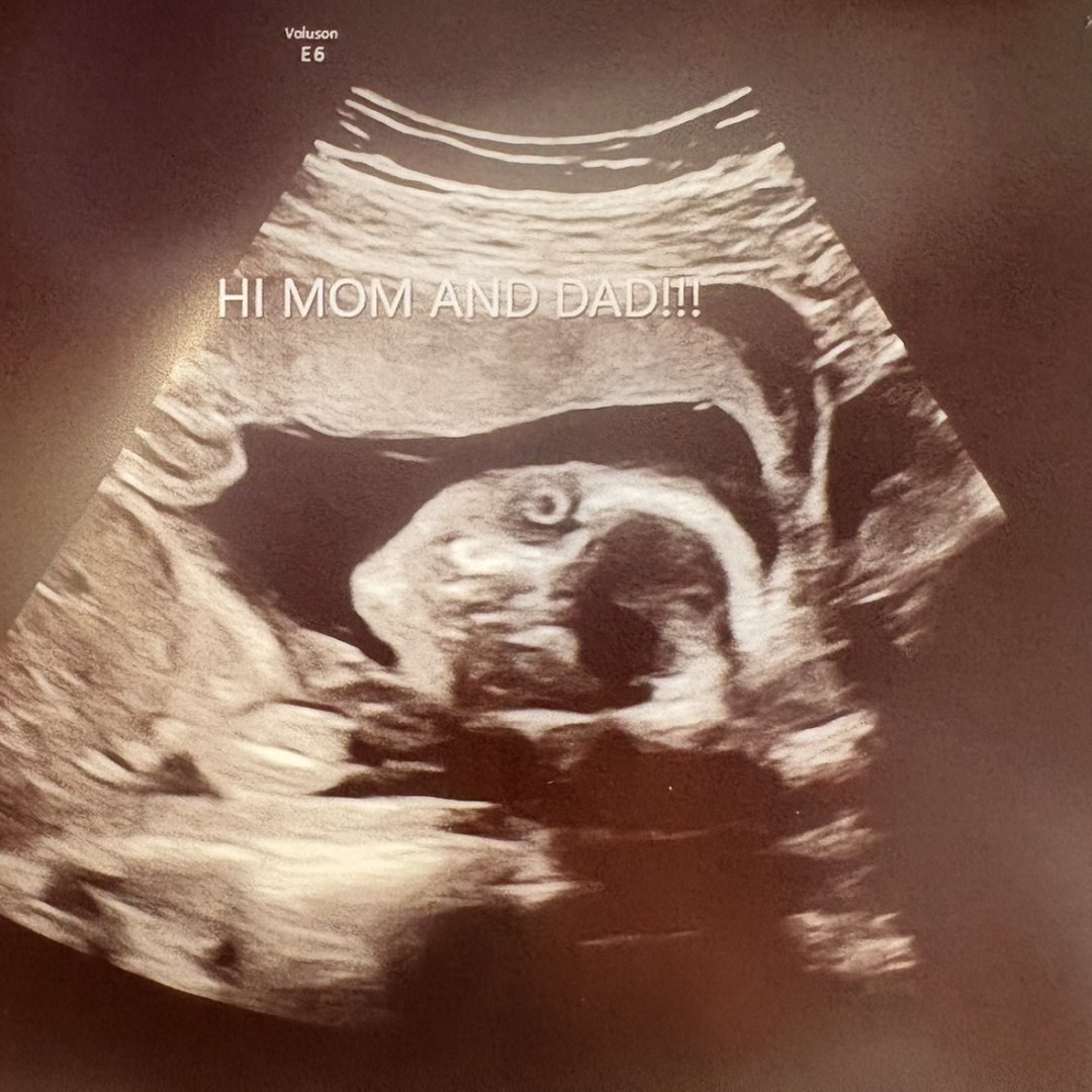 Photo shared by Kaylee for their Babylist baby registry.