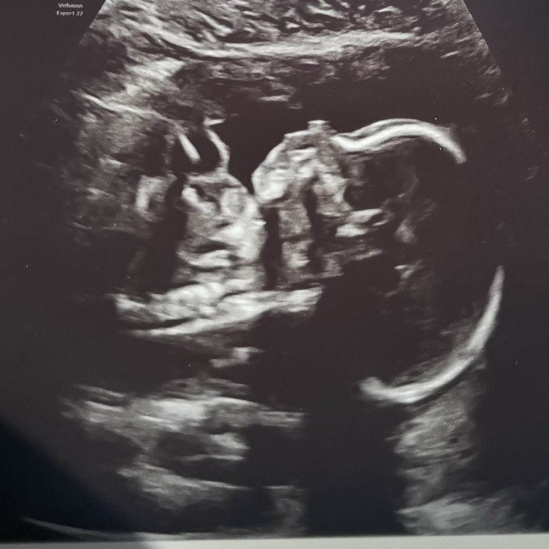 Photo shared by Ayanna for their Babylist baby registry.